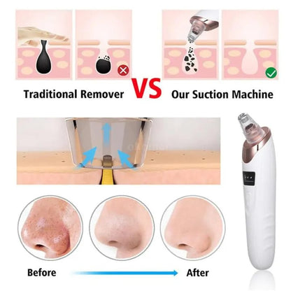 Electric Blackhead Remover Vacuum